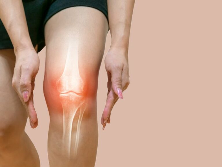 Osteoporose Knochengesundheit 5 Fragen zur Vorsorge und Behandlung